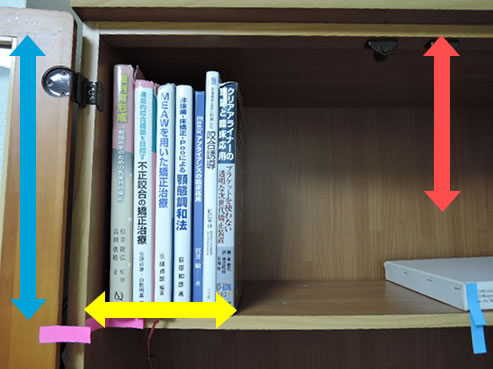 本棚を例にした矯正の仕組み