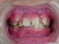 090928　whole teeth_copy.jpg