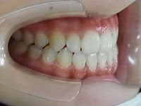 101225 teeth side_copy.jpg