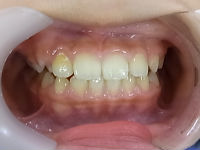 110421 whole teeth_copy.jpg
