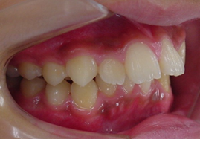 20180628-01.pngのサムネール画像のサムネール画像