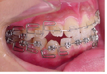 20180628-6.pngのサムネール画像