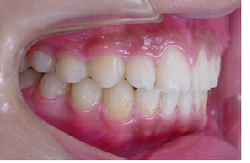 20180629-1.pngのサムネール画像