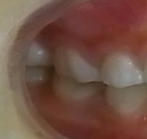 180829.jpgのサムネール画像