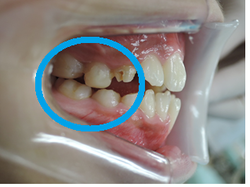 20180904-1.pngのサムネール画像