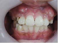 20180906-2.pngのサムネール画像