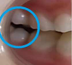 20180910-17.pngのサムネール画像