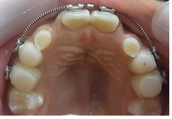 20180915-10.pngのサムネール画像