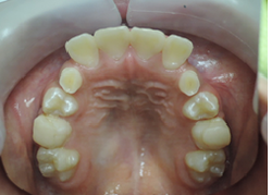 20180915-11.pngのサムネール画像