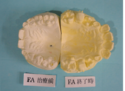 20180915-12.pngのサムネール画像のサムネール画像