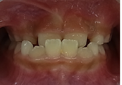 20180915-13.pngのサムネール画像のサムネール画像