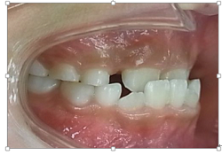 20180915-2.pngのサムネール画像