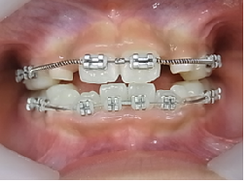 20180915-7.pngのサムネール画像