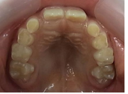 20180915-8.pngのサムネール画像