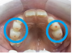 20180915-9.pngのサムネール画像