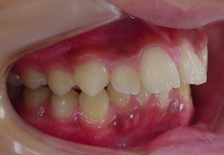 181007-1.jpgのサムネール画像