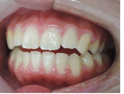 20181016-1.pngのサムネール画像