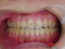 s-080121 whole teeth.jpg