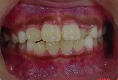 s-080403 whole teeth cut.jpg