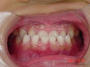 s-090522 whole teeth.jpg