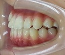 s-101009 teeth side2 cut.jpg