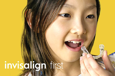 子供のインビザライン