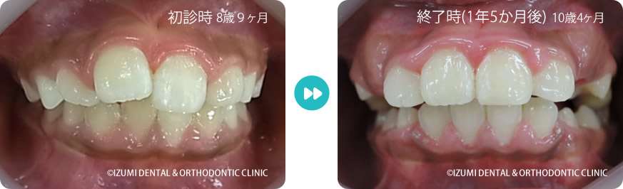 初診時～終了時