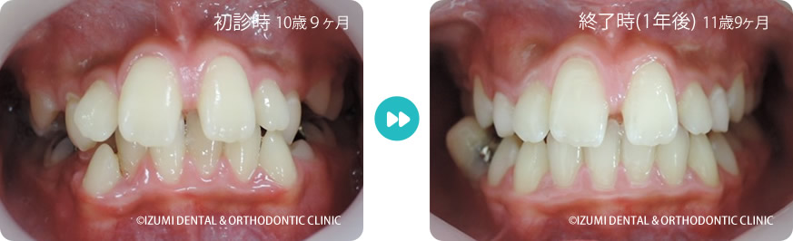 初診時～終了時(1年後)