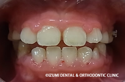 終了時(1年6ヶ月)