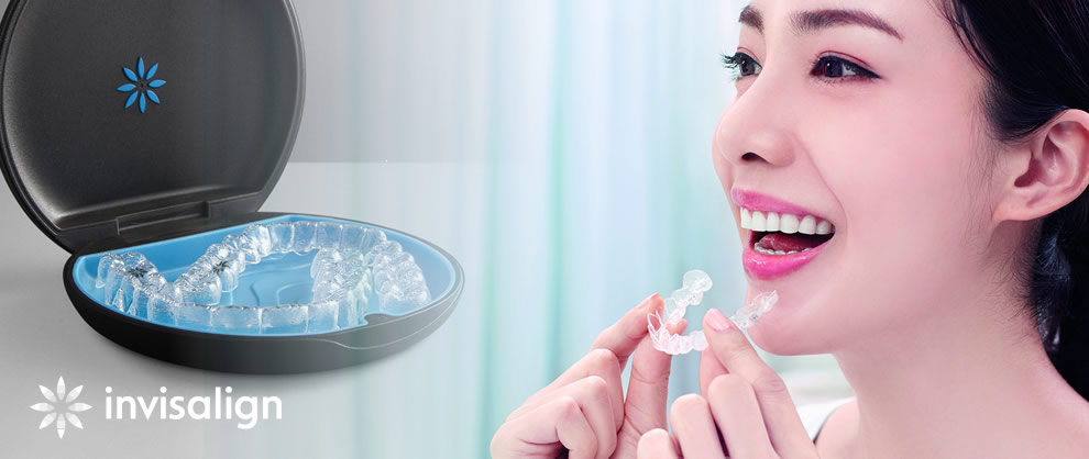 インビザライン